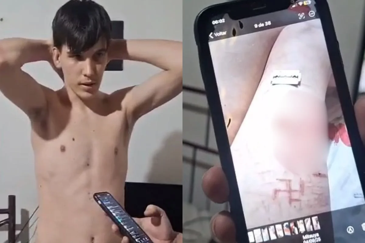 Automutilação incentivada online: caso acende alerta às famílias