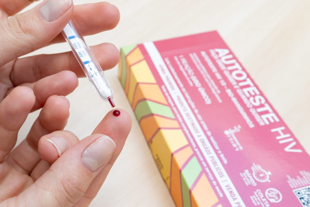 Jundiaí amplia testes rápidos para HIV e sífilis na rede pública